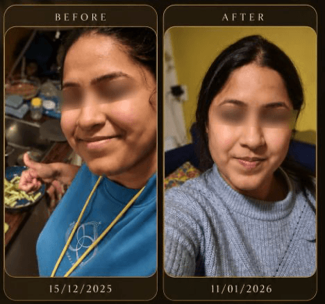 Before and after, Dec 2025 — Jan 2026