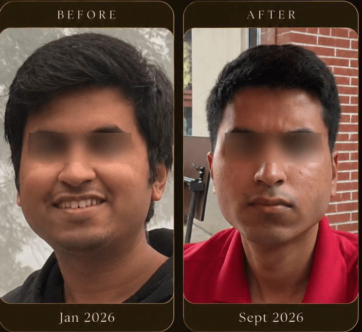 Before and after, Jan 2026 — Sept 2026